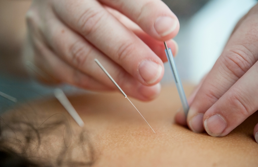 can you get a massage after acupuncture?